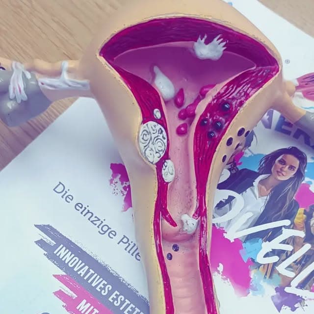 Model ženské anatomie na odborné konferenci